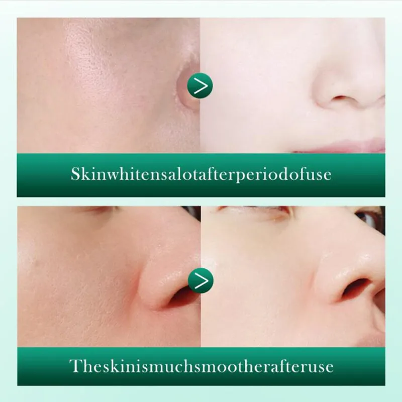 40ML רטינול הפנים סרום עם Centella נגד קמטים הלבנת לחות הבהרה רטינול, תמצית לטיפול בעור - 1